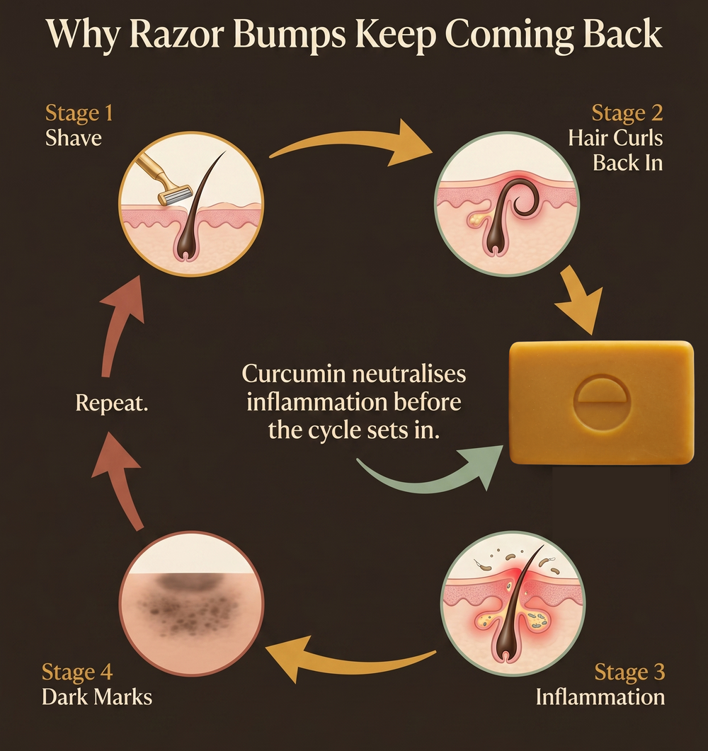 2. Every Shave Feels Like One Step Forward, Two Marks Back.