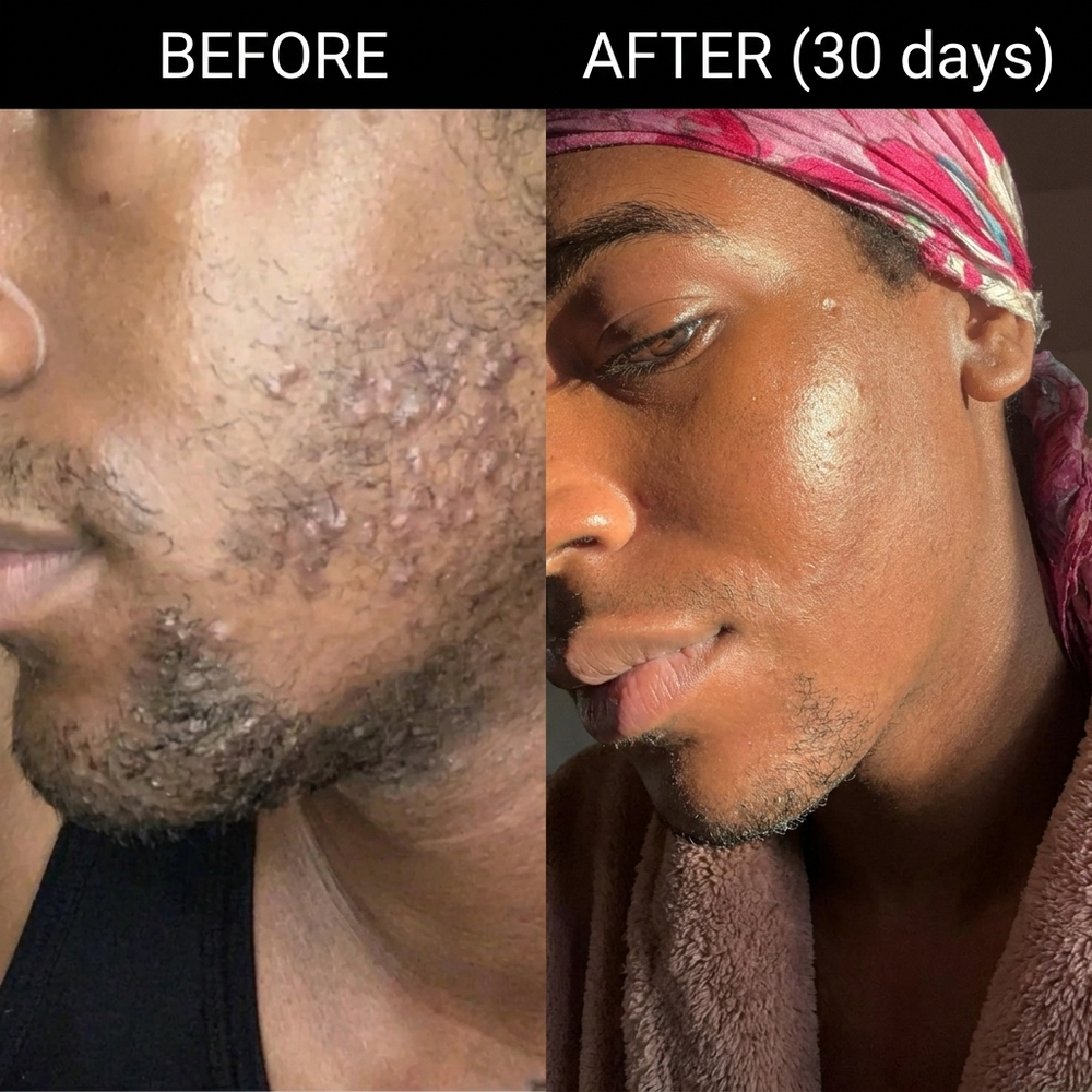 5. It Is Not That Your Skin Won’t Fade. Nothing Has Worked Where It Counts.
