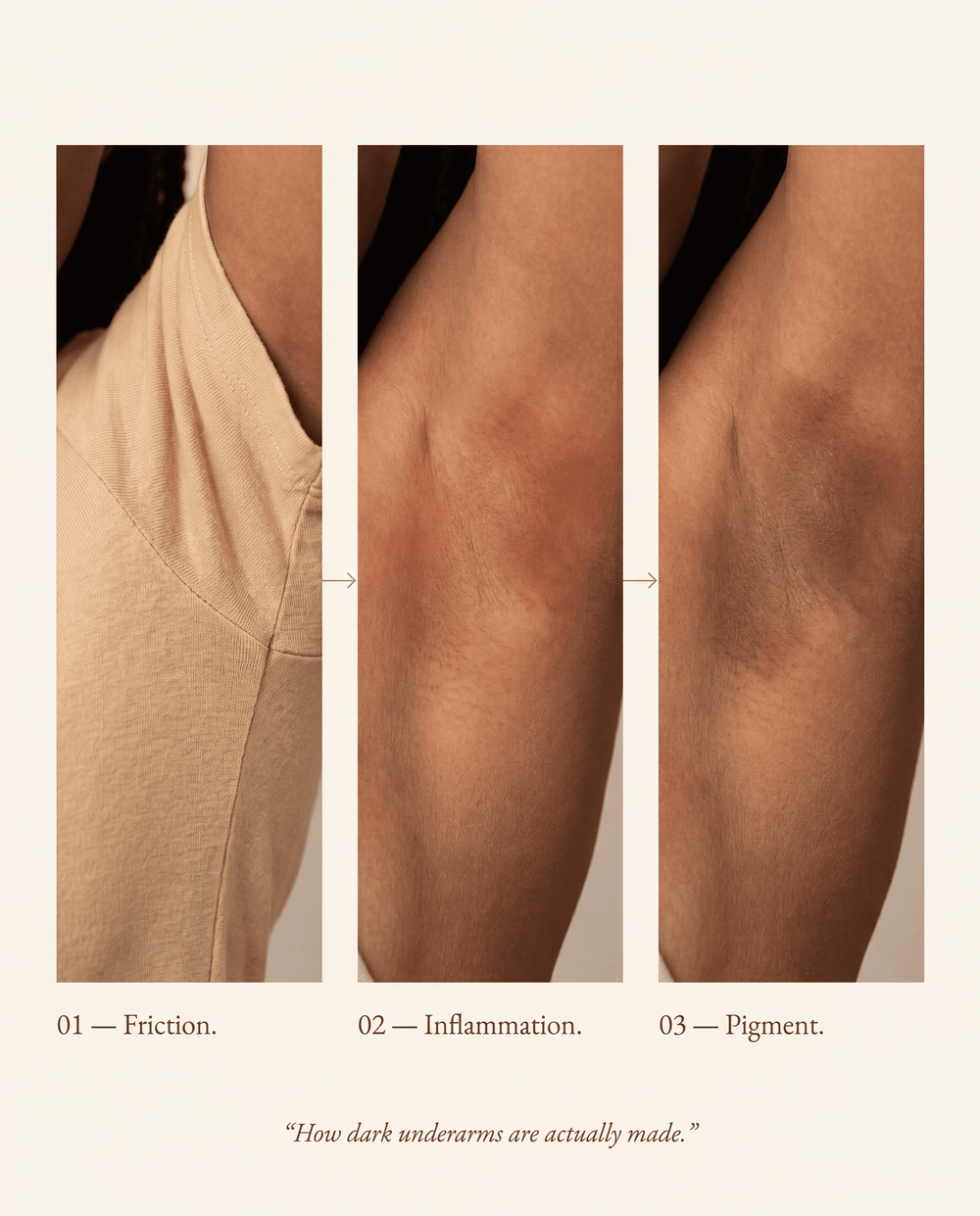 1. Friction Keeps Triggering The Pigment